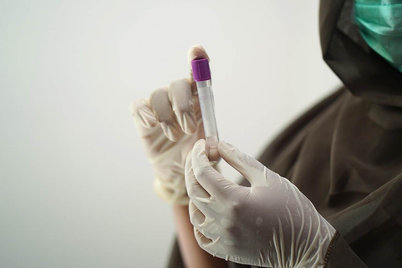 Vials of blood samples being handled by a lab technician for diagnostic testing