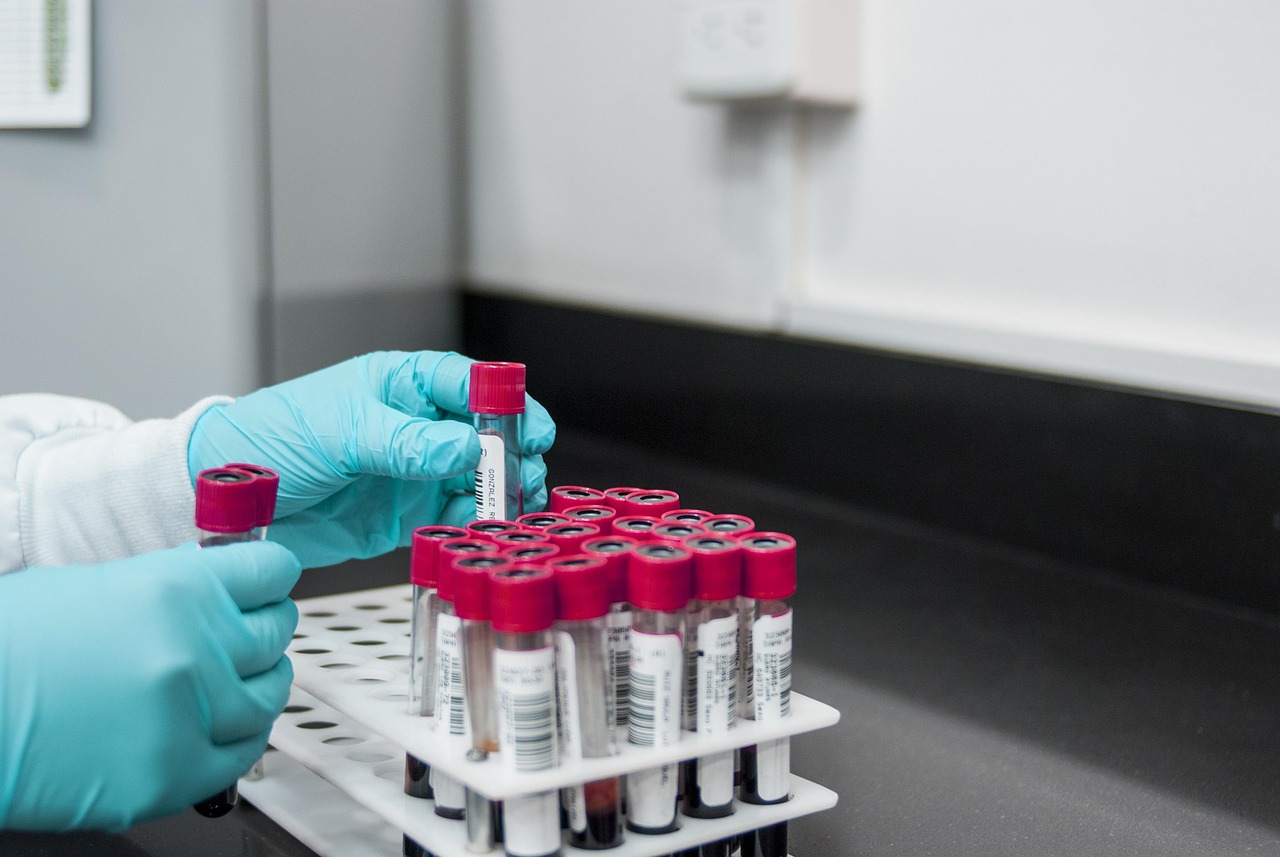 Gloved hands handling test tubes with blood samples in a clinical lab setting