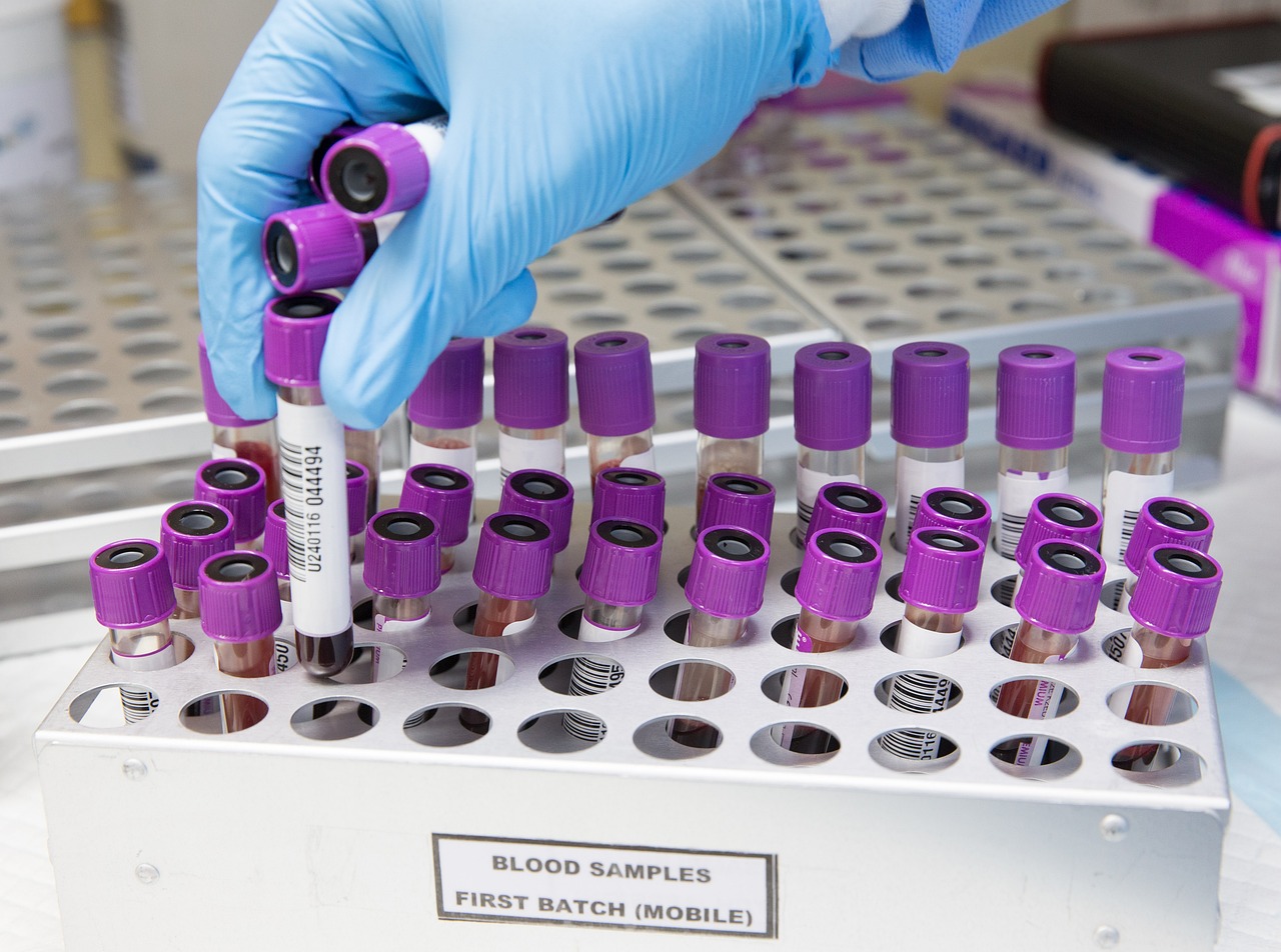 A researcher in a laboratory examining samples, representing the biochemical study of collagen synthesis