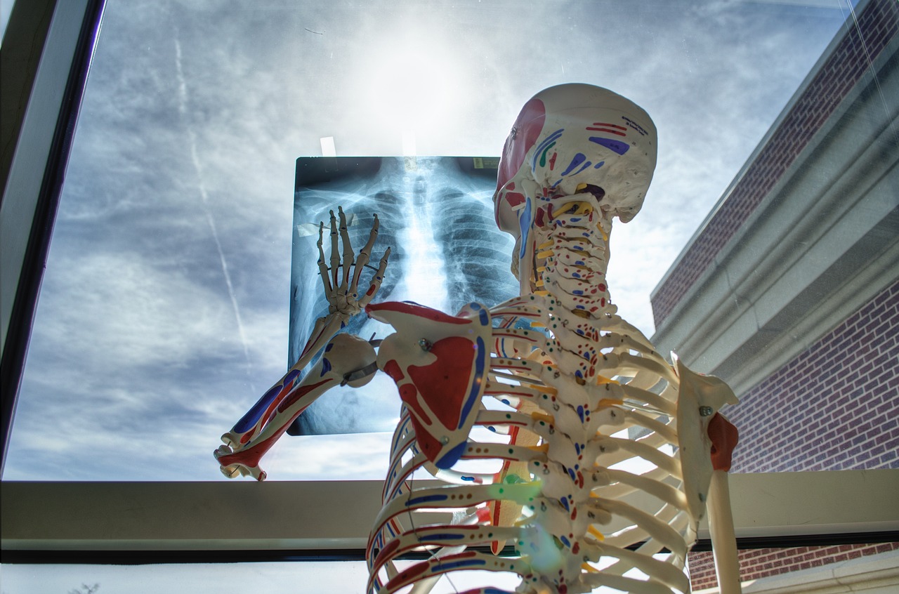 Knee X-ray image showing bone and joint structure, illustrating how imaging is used to assess skeletal health