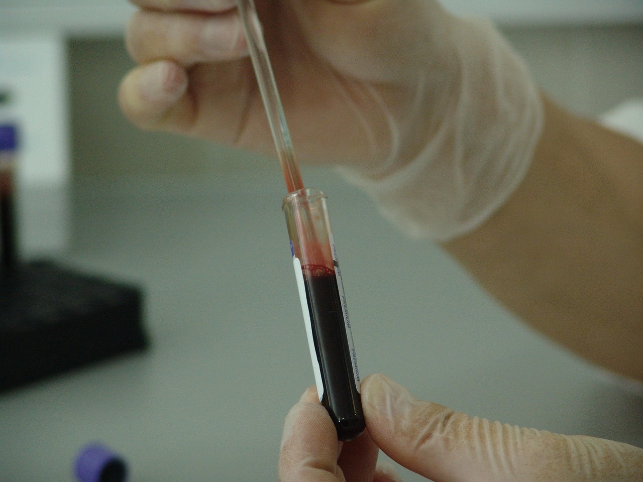 Laboratory vial and sample tube used for clinical trial blood analysis