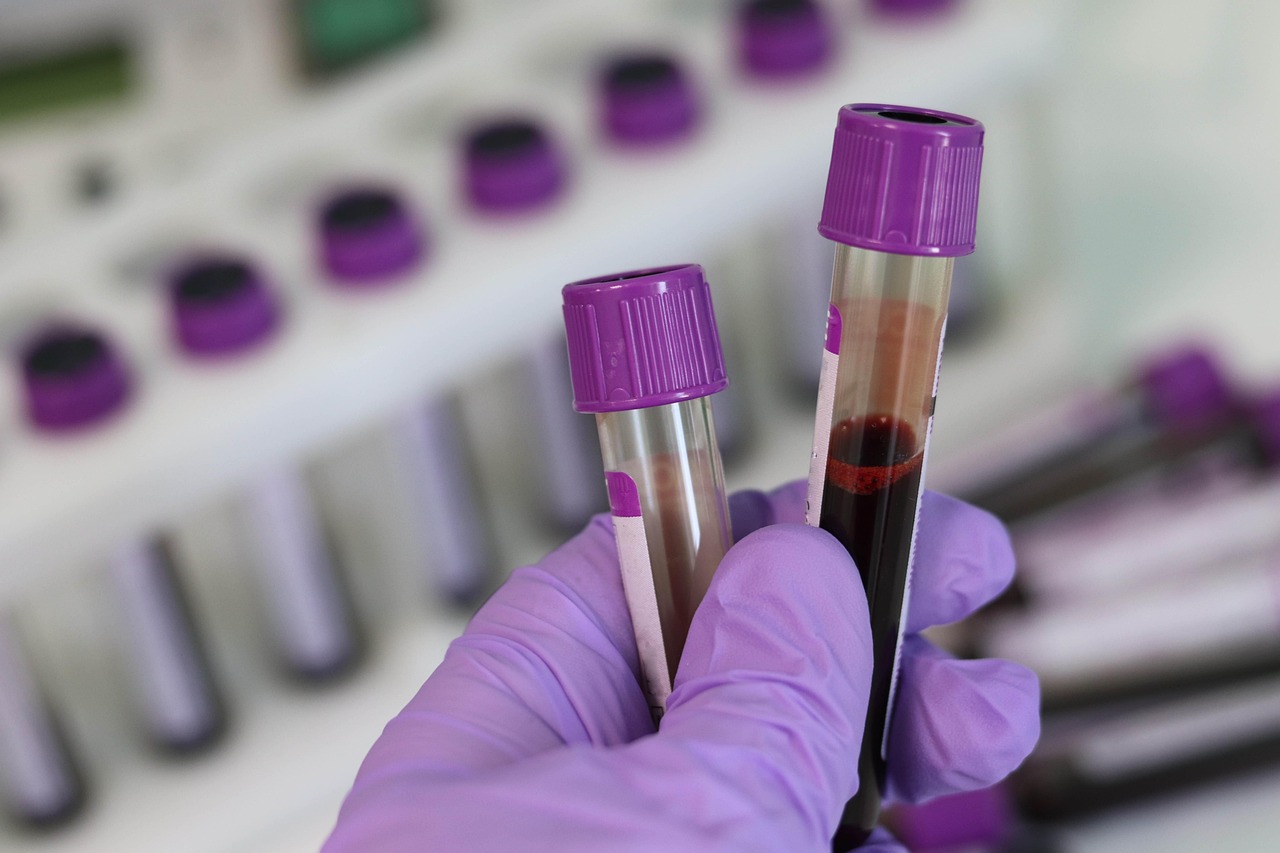 Researcher in a lab coat and gloves examining samples on a laboratory bench