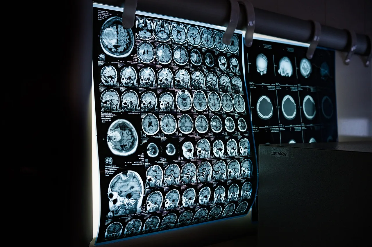 GLP-1s and Cognitive Health: Early Signals